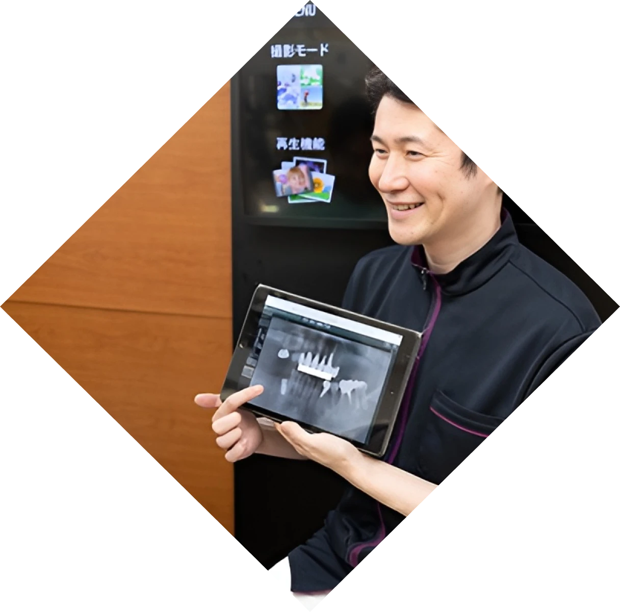 こだわりのインプラント治療